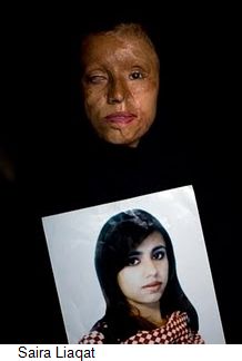 aira-liaqat-acid-attack-victim