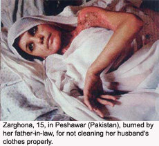 Zarghona-Peshawar-Pakistan-burned-by-father-in-law.jpg